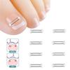 Ingrown Toenail Corrector Tools Pedicure Recover Embed Toe Nail Treatment Professional Ingrown Toenail Straightening Clip Brace