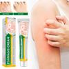 , Ointment, , Ease Red And Itchy Skin On Hands And Feet For For