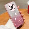For Honor X9 Case Honor X9 5G Magic 4 Lite Phone Case Shiny Glitter Plating Silicone Camera Lens Soft Back Cover