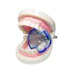 2Pcs Mouth Opener Dental Orthodontic Braces Lip Cheek Retractor Expander Dental Mouth Oral Tooth Tool Care Orthodontic Accessory