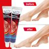 ZB Relief Paste Improve Blood Circulations Spider For Tired Heavy Legs Fast Relief Ointment 20g
