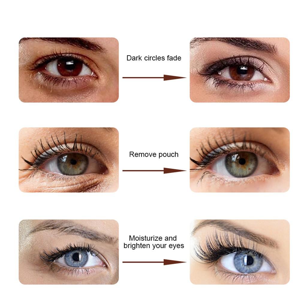 Eye Delights Boosts Serum Remove Dark Circles  Wrinkle Eye Cream Effective