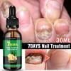 Nail Fungal Treatment Device 7 Days Repair Oil Foot Toe Essence Anti Infection Paronychia Ginger Onychomycosis Gel Care Products