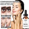 Shrink Pore Face Serum Niacinamide Whitening Fade Dark Spots Remove Melanin Anti Aging Moisturizing Brighten Facial Essence
