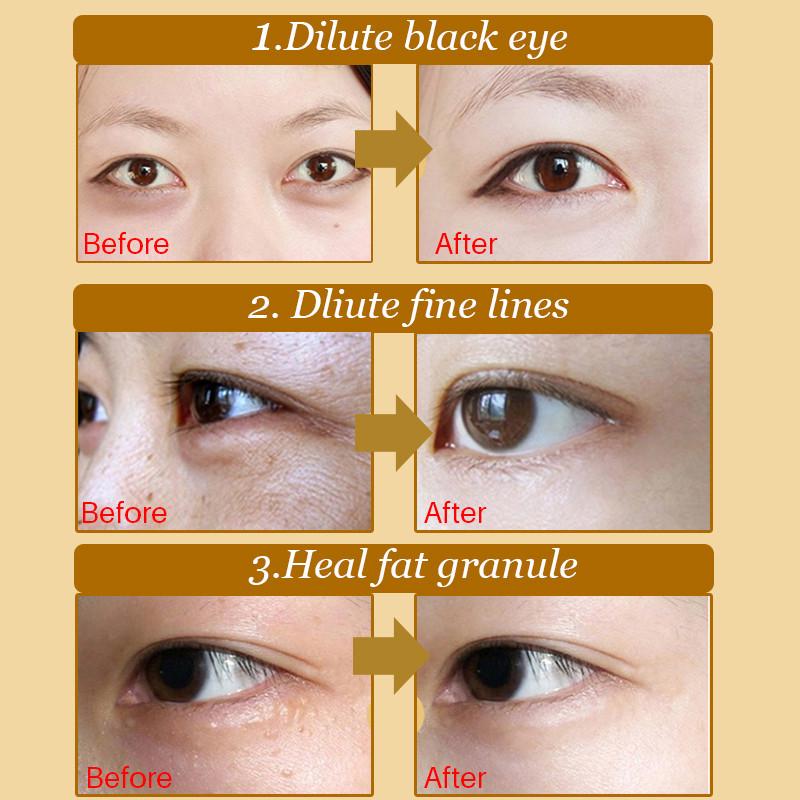 30pcs Gold Eye Mask Patches Crystal Collagen Anti Aging Remove Puffiness Dark Circles Moisturizing Sleep Eyes Pads Gel Skin Care