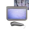 10.1inch Charging Type Scalp Hair Follicle Skin Hair Detector Analyser Machine 100‑240V