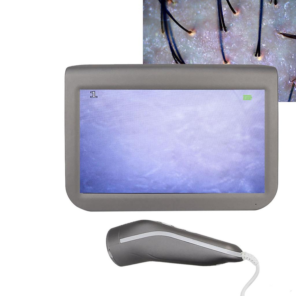 10.1inch Charging Type Scalp Hair Follicle Skin Hair Detector Analyser Machine 100‑240V