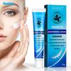 Scar Cream Removal Cream Skin Repair Face Cream Rejuvenating Cream