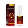 Hair Growth Ginger Spray Hair Loss Treatment Oil Fast Growing Hair Oil Hair Loss Care Spray Beauty Hair Scalp Treatment