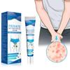 Men's Skin Care Yin Itch Thigh Inner Itch Relief Gentle Application Of Skin Regain Dryness And A Relaxed Feeling