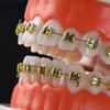 Dental Orthodontic Teeth Model With Metal Braces School Teaching Equipment