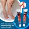 ZB Relief Paste Improve Blood Circulations Spider For Tired Heavy Legs Fast Relief Ointment 20g