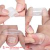 Silicone Ingrown Toenail Correction Tool Invisible Ingrown Toe Nail Treatment