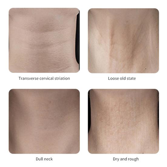 Instant Neck Lift Tape Straps Waterproof Neck Patch for Face Jaw Invisible Natural Lifting Band Young Neckline Enhancer