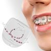 Temporary Tooth Decoration with Case for Classroom Instruction Fashion Brace