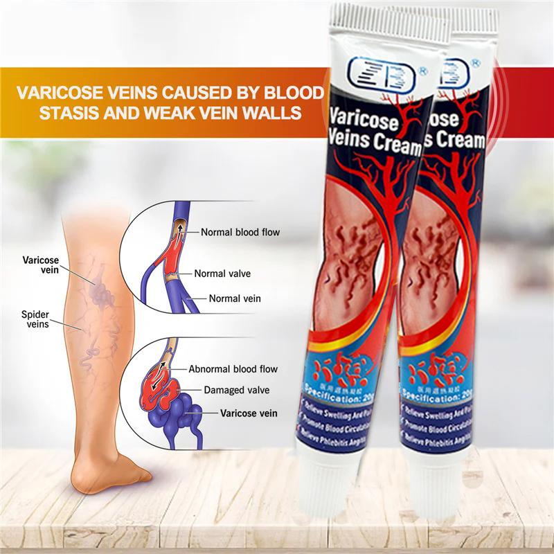 ZB Relief Paste Improve Blood Circulations Spider For Tired Heavy Legs Fast Relief Ointment 20g