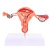 Pathological Uterus Ovary Anatomical Model Anatomy Cross Section Study Tool