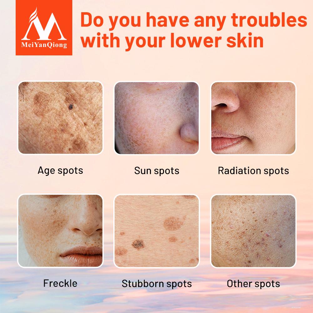 Freckle Cream Skin Care Whitening Anti-aging Moisturizing Cream Melanin Removing Freckle Speckle Firm Skin Care Face Care