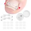 Ingrown Toenail Corrector Kit for Curved Nail Stainless Steel Armor Buckle Toe Nail Straightener Ingrown Nail Tool