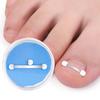 Pedicure Tool Ingrown Toenails Corrector Toenail Fixer Bunion Corrector Toenail Straightener