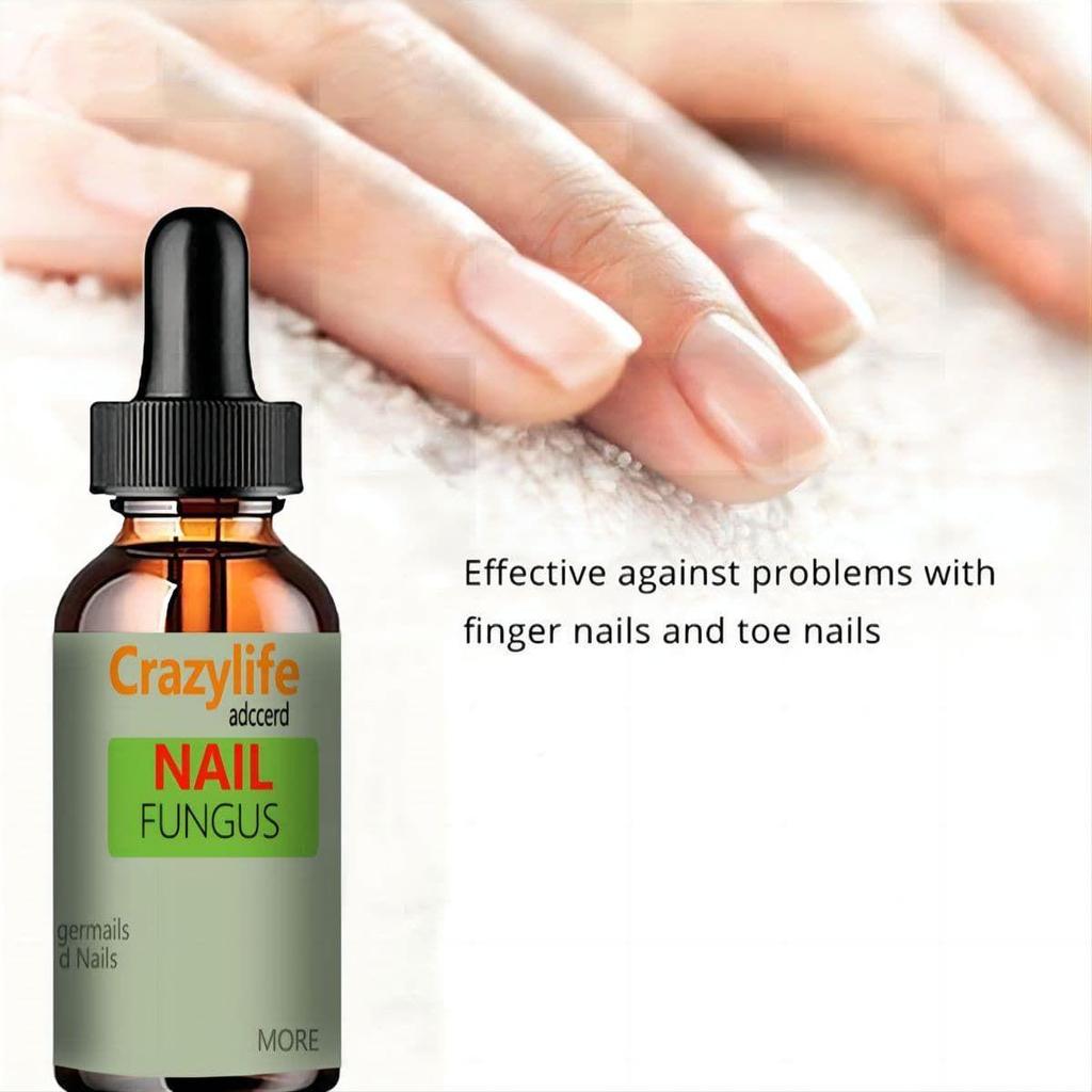 Hand and Foot Nail Onycho Repair Nail Onychomycetant for Thickening Nail Suppressant