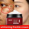 Whitening Freckle Cream Remove Melasma Spot Acne Pigment Melanin Dark Spots Pigmentation Freckle Removal Cream