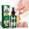 Toenail Fungus Care, FastActing Nail Care Liquid For Fungus Under & Around Restores The Healthy Appearance Of Nails 30ml