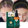 Ginger Hair Treatment Essential Oil Essence Original Genuine 100% Hair Loss Liquid Health and Beauty Thick Hair Growth Essence
