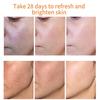 Whitening Freckle Cream Remove Melasma Spot Acne Pigment Melanin Dark Spots Pigmentation Freckle Removal Cream