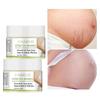 Stretch Marks Remover Cream Moisturizing Repair Pregnancy Scars Anti Winkle Firming Maternity Skin Care