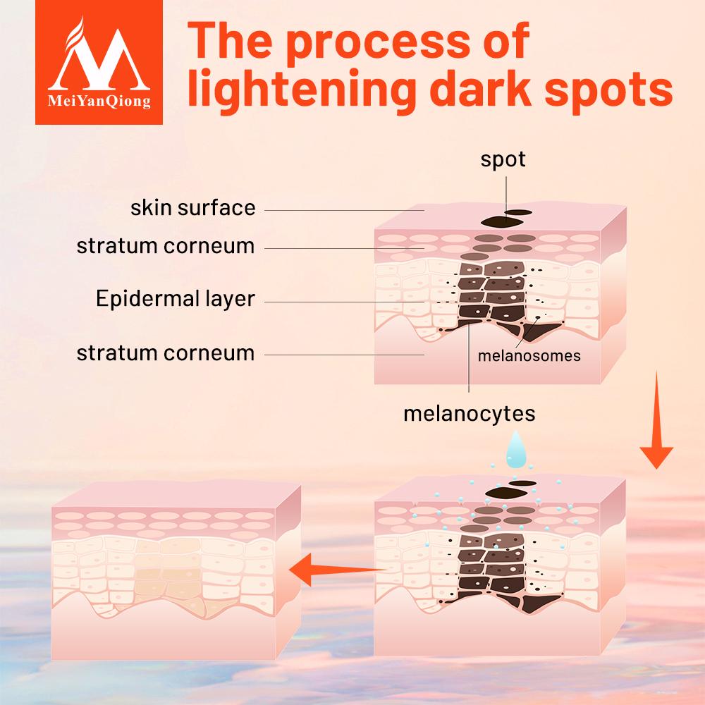 Freckle Cream Skin Care Whitening Anti-aging Moisturizing Cream Melanin Removing Freckle Speckle Firm Skin Care Face Care