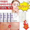 1+1 Freckle Patch, Age Spot Removal Patch, Melatoning, Facial Pigmentation, Freckle Whitening, Blemish Whitening, 32 Pieces, 2 Pieces
