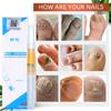 Yousheng 4Pcs 3ml Nail Treatment Solution Reusable Effective Lightweight Nail Nourishment Repair Pen Liquid for Women