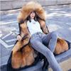 Women's Fur Detachable Shearling Winter Parka - Plus Size Warm Thick Down Jacket