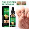 Ginger Nail Care Liquid, Repair Hand and Foot Nail Care, Soft Nail Polish, Moisturizing Liquid, Onychomycosis