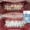 Teeth Powder Can Whiten Your Teeth Within Three Days, Providing a Layer of Protection and Making Your Mouth Feel Comfortable