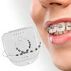 Temporary Tooth Decoration with Case for Classroom Instruction Fashion Brace