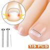 Ingrown Toenail Corrector Tools Pedicure Recover Embed Toe Nail Treatment Professional Ingrown Toenail Straightening Clip Tool