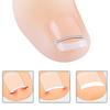 Ingrown Toenail Corrector Tools Pedicure Recover Embed Toe Nail Treatment Professional Ingrown Toenail Straightening Clip Tool