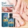 N Ail Treatment N Ail Treatment Nail Treatment Toenail Care, FastActing Nail Care Liquid for Around Restores The Healthy Appearance of Nails 30ml