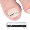 Titanium Alloy Toenail Correction Wire Ingrown Nail Treatment Device Stickers Silicone Tool Foot Care Accessories Daily Use