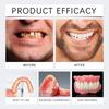 Denture Set With Cleaning Tablets Confident Smile Enhance The Aesthetics Of Your Smile Comfortable Material Dentures