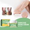 Venous R Epair C Ream For Leg Massage To  Soreness And  Worm Leg Venous Care