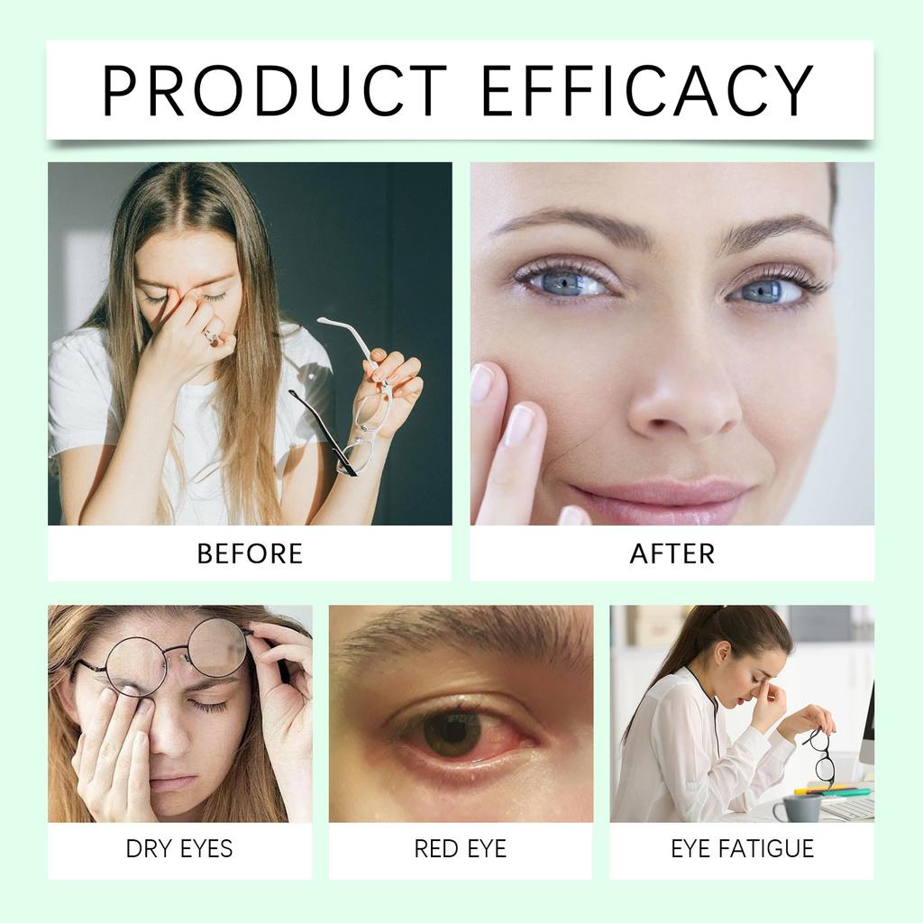 Eye Care Eye Drops Moisturizing Eye Care Improve Blurred  Moisturizing Gentle Eye Care(2ml*10)