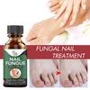 50ML Nail Treatment Solution Nail Repair Liquid Accelerate Metabolism Onychomycosis Treatment