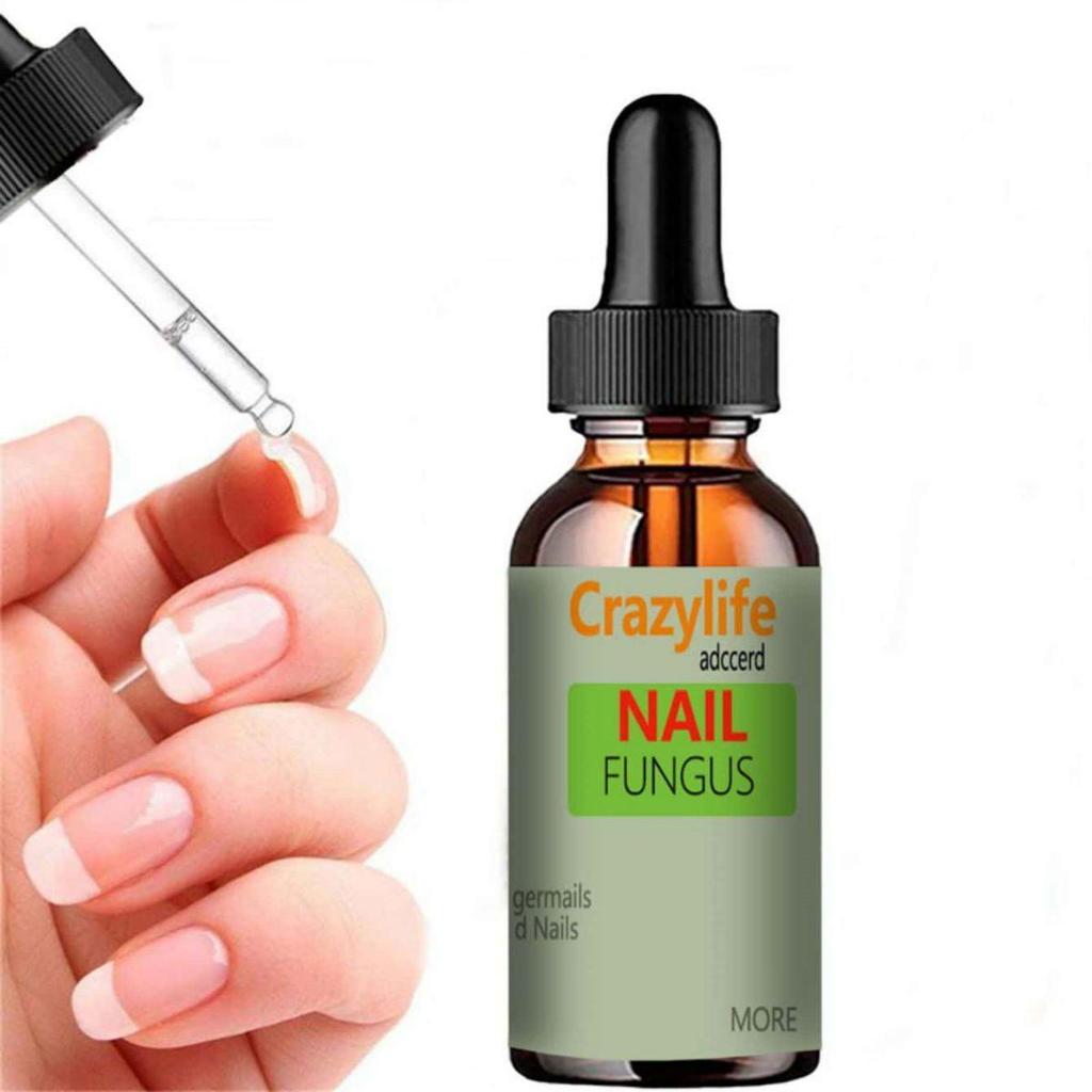 Hand and Foot Nail Onycho Repair Nail Onychomycetant for Thickening Nail Suppressant