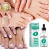30ML 1FL OZ Toenail Fix Liquid To Fix Nails, Rotten Toenails, Mild Toenails, Mild Toenails,Bright Nails,