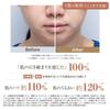 YA-MAN Facial Beauty Device Photo Plus Deep Lift Lift Up RF EMS YJFA1T Bronze
