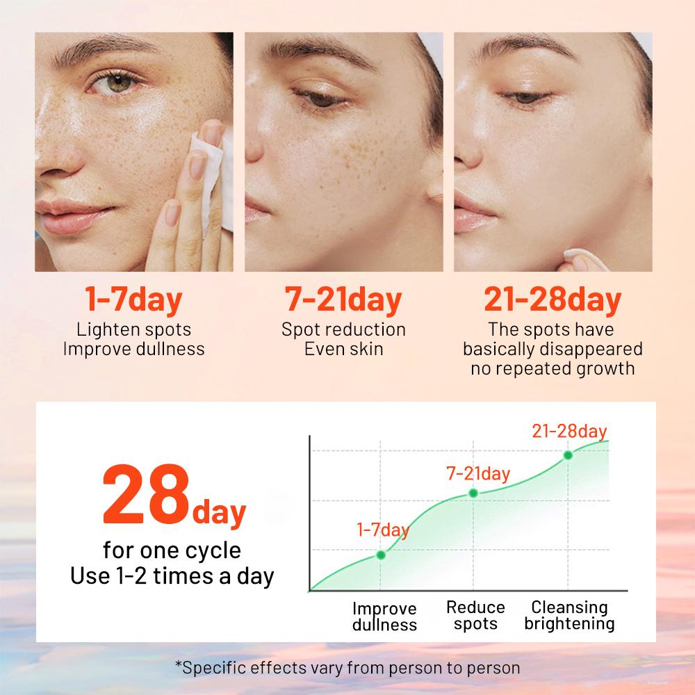 Freckle Cream Skin Care Whitening Anti-aging Moisturizing Cream Melanin Removing Freckle Speckle Firm Skin Care Face Care