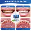 When Using Seven Day Teeth Whitening, You Can Feel the Cleaning of Your Teeth